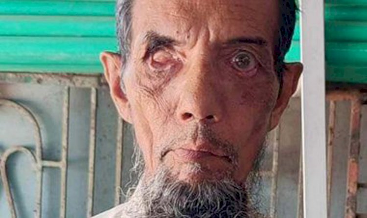 In Naogaon, check of PM Relief and Welfare Fund grant goes to the hands of the visually impaired