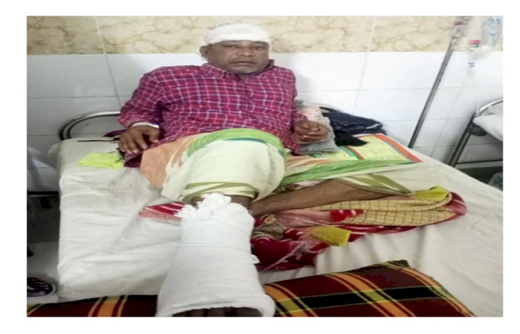In Naogaon, UP member brutally attacked with sharp weapons for speaking to police
